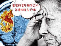 老年癡呆癥會(huì)不會(huì)遺傳