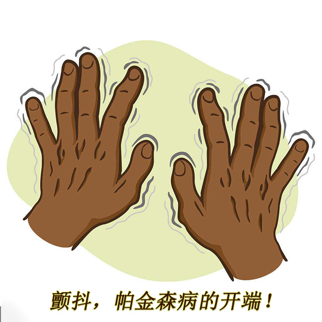 顫抖，帕金森病的開端 帕金森的早期癥狀