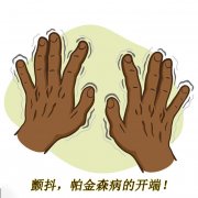 顫抖，帕金森病的開(kāi)端 帕金森的癥狀有哪些